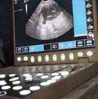 Ultrasound